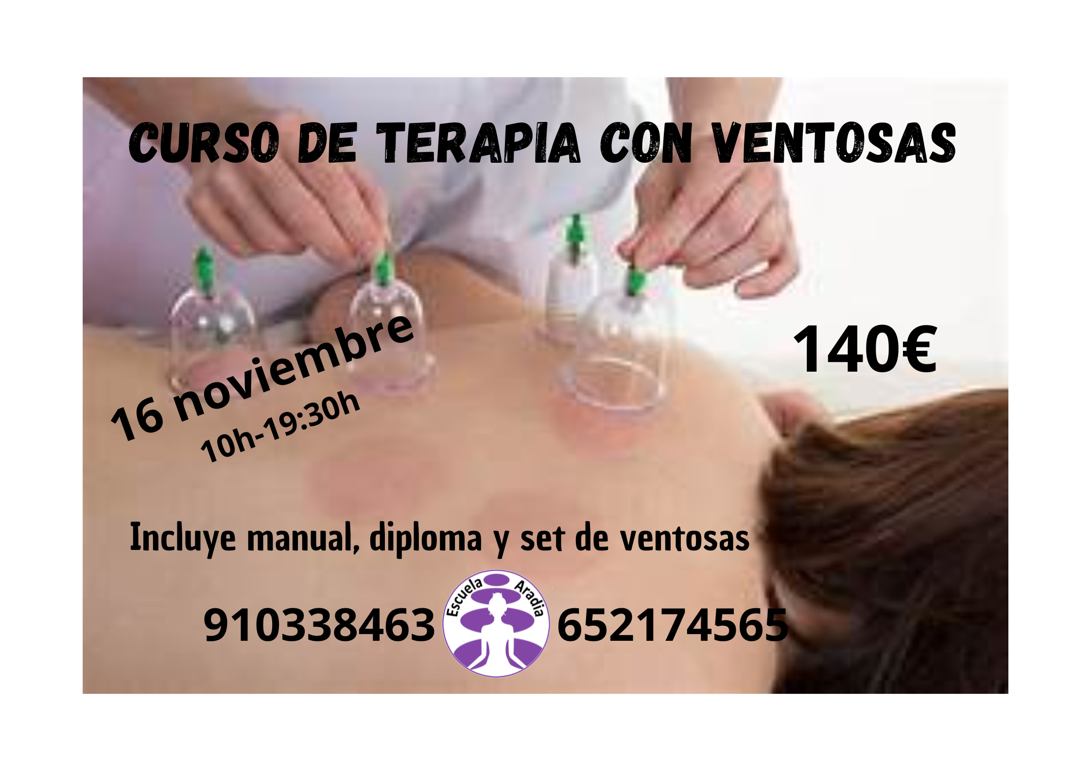 Curso de Terapia Con Ventosas